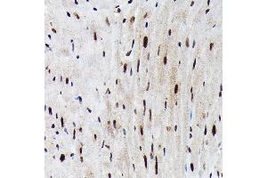 Immunohistochemistry of paraffin-embedded mouse heart using Phospho-FOXO3A-S425 Rabbit pAb (ABIN7267246) at dilution of 1:250 (40x lens).
