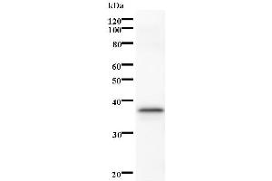 Western Blotting (WB) image for anti-serine/threonine Kinase 3 (STK3) antibody (ABIN933165)