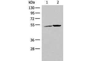 Western blot analysis of K562 cell and Human heart tissue lysates using FECH Polyclonal Antibody at dilution of 1:500 (FECH anticorps)