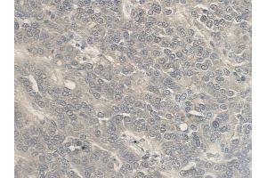 anti-IGF-Like Family Member 1 (IGFL1) antibody