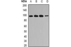 Western blot analysis of INPP4A expression in Jurkat (A), MCF7 (B), mouse testis (C), rat skeletal muscle (D) whole cell lysates. (INPP4A anticorps)