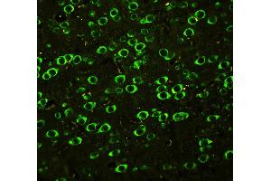 Anti-ABI1 antibody, IHC(P): Rat Brain Tissue