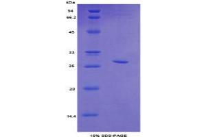 SDS-PAGE analysis of Mouse Topoisomerase II beta Protein. (TOP2B Protéine)