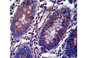 Anti-Vimentin antibody immunohistochemistry analysis in formalin fixed and paraffin embedded human colon tissue.
