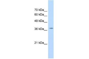 WB Suggested Anti-RALY Antibody Titration:  1. (Raly anticorps  (C-Term))
