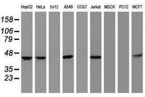 Image no. 3 for anti-Chromobox Homolog 8 (CBX8) (AA 1-260) antibody (ABIN1490660) (CBX8 anticorps  (AA 1-260))