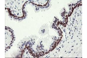 Image no. 2 for anti-Adipocyte Plasma Membrane Associated Protein (APMAP) antibody (ABIN1496661)