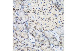 Immunohistochemistry of paraffin-embedded rat pancreas using T Rabbit mAb (ABIN7270729) at dilution of 1:100 (40x lens). (TARBP2 anticorps)