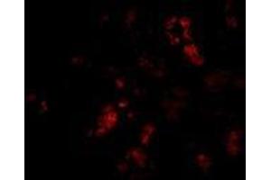 Immunofluorescence of BANF1 in human kidney tissue with AP30118PU-N BANF1 antibody at 20 μg/ml.