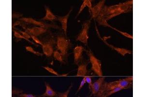 Immunofluorescence analysis of C6 cells using RECK Polyclonal Antibody at dilution of 1:100 (40x lens). (RECK anticorps)