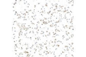 Immunocytochemistry (ICC) image for anti-Oxidized Low Density Lipoprotein (Lectin-Like) Receptor 1 (OLR1) (AA 61-273) antibody (ABIN7795657)