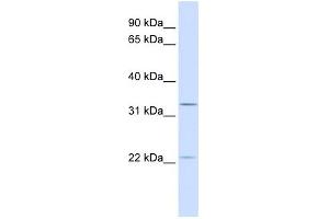 BRI3BP antibody used at 1 ug/ml to detect target protein. (BRI3BP anticorps  (C-Term))