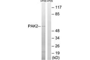 Western blot analysis of extracts from HT-29 cells, using PAK2 (Ab-197) Antibody. (PAK2 anticorps  (AA 163-212))