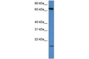 Image no. 1 for anti-Solute Carrier Family 5 (Sodium/glucose Cotransporter), Member 2 (SLC5A2) (AA 250-299) antibody (ABIN6747267) (SLC5A2 anticorps  (AA 250-299))