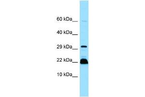 WB Suggested Anti-MYLPF Antibody Titration: 1. (MYLPF anticorps  (C-Term))