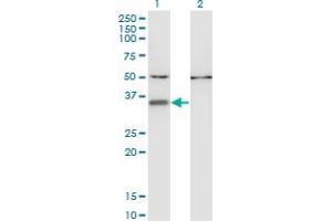 Western Blot analysis of CENPV expression in transfected 293T cell line by CENPV monoclonal antibody (M05), clone 1D9. (CENPV anticorps  (AA 173-272))