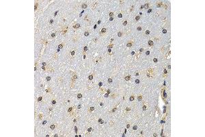 Immunohistochemistry of paraffin-embedded mouse brain using DNASE1 antibody at dilution of 1:200 (400x lens). (DNASE1 anticorps)