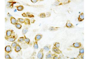 Anti-Thrombospondin 2 antibody, IHC(P) IHC(P): Human Placenta Tissue