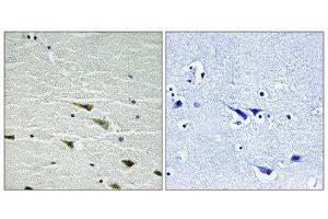 Immunohistochemistry (IHC) image for anti-Neurotrophic Tyrosine Kinase, Receptor, Type 1 (NTRK1) (pTyr757) antibody (ABIN1847659) (TRKA anticorps  (pTyr757))