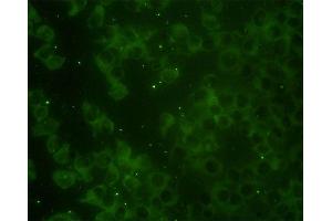 Immunofluorescence of monoclonal antibody to RAP2B on HeLa cell.