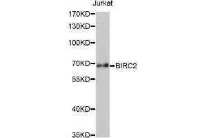 Western blot analysis of extracts of Jurkat cells, using BIRC2 antibody (ABIN5970373) at 1/1000 dilution. (BIRC2 anticorps)