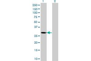 Western Blot analysis of KHK expression in transfected 293T cell line by KHK monoclonal antibody (M01), clone 1H6-2B6.
