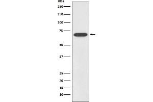 Western blot analysis of SOX11 expression in SHSY5Y cell lysate.