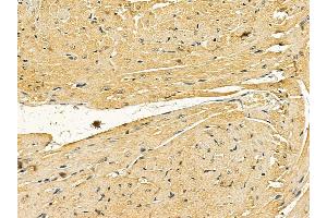 C-RAF Mouse Monoclonal Antibody at 1/100 staining mouse heart tissue by IHC-P. (RAF1 anticorps)