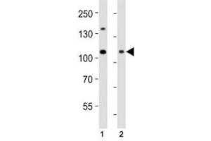 Western blot analysis of lysate from (1) HeLa cell line and (2) human skeletal muscle tissue using Dnmt3a antibody at 1:1000.