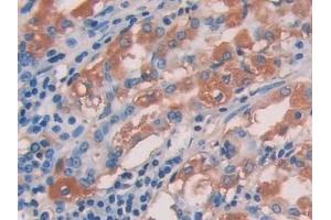 Detection of IL15 in Human Stomach Tissue using Polyclonal Antibody to Interleukin 15 (IL15)