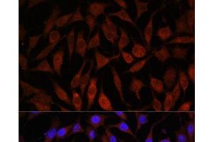 Immunofluorescence analysis of L929 cells using NEDD4L Polyclonal Antibody at dilution of 1:100.