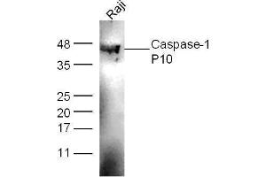 Raji cell lysates probed with Anti-Caspase-1 P10 Polyclonal Antibody  at 1:5000 for 90 min at 37˚C. (Caspase 1 (p10) anticorps  (AA 320-404))