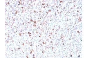 Formalin-fixed, paraffin-embedded human spleen stained with Lambda Light Chain Recombinant Rabbit Monoclonal Antibody (LLC/3778R). (Recombinant IgL anticorps)