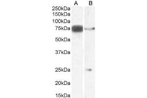 ABIN361190 (0. (DLL1 anticorps  (Internal Region))