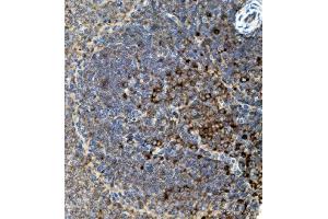 IHC analysis of CD74 using anti-CD74 antibody (ABIN7603166). (CD74 anticorps  (N-Term))