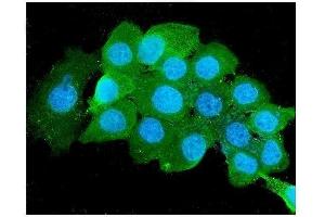 IF analysis of Beta 2 Microglobulin using anti-Beta 2 Microglobulin antibody (ABIN6719452). (beta-2 Microglobulin anticorps  (AA 22-119))