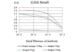 Black line: Control Antigen (100 ng),Purple line: Antigen (10 ng), Blue line: Antigen (50 ng), Red line:Antigen (100 ng)