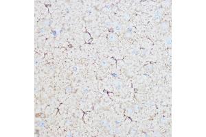 Immunohistochemistry of paraffin-embedded mouse brain using ALDOC Rabbit pAb (ABIN6129897, ABIN6136788, ABIN6136789 and ABIN6215308) at dilution of 1:100 (40x lens).