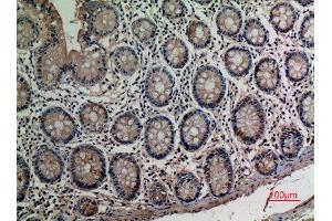 Immunohistochemistry (IHC) analysis of paraffin-embedded Human Colon, antibody was diluted at 1:100. (AAT (Internal Region) anticorps)