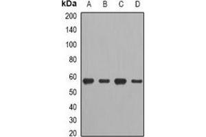 Western blot analysis of CCT2 expression in A549 (A), HT29 (B), mouse spleen (C), mouse heart (D) whole cell lysates.