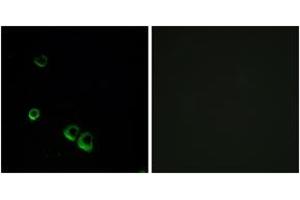 Immunofluorescence analysis of MCF7 cells, using AVPR2 Antibody. (AVPR2 anticorps  (AA 72-121))