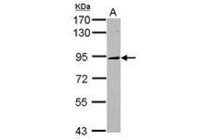 Image no. 1 for anti-Kinesin Family Member 2C (KIF2C) (AA 9-287) antibody (ABIN1499045)