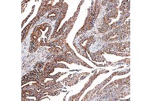 IHC analysis of DYNLT1 using anti-DYNLT1 antibody (ABIN5693148).