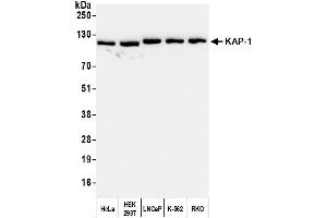 Western Blotting (WB) image for anti-Tripartite Motif Containing 28 (TRIM28) (AA 650-700) antibody (ABIN7453436) (KAP1 anticorps  (AA 650-700))