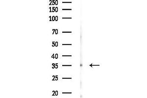 anti-Olfactory Receptor 1E5 (OR1E1) (C-Term) antibody