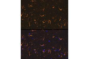 Immunofluorescence analysis of rat brain cells using GFAP Rabbit pAb (ABIN3020750, ABIN3020751, ABIN3020752, ABIN1512943 and ABIN6213705) at dilution of 1:100 (40x lens).