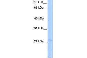 WB Suggested Anti-C5orf39 Antibody Titration: 0. (Chromosome 5 Open Reading Frame 39 (C5orf39) (N-Term) anticorps)