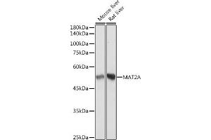 Western blot analysis of extracts of various cell lines, using MA antibody (ABIN7268487) at 1:3000 dilution. (MAT2A anticorps)