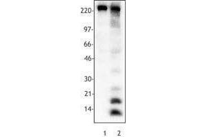 Western Blotting (WB) image for anti-Acetylated Lysine (acetylated) antibody (ABIN2666081) (Acetylated Lysine anticorps  (acetylated))