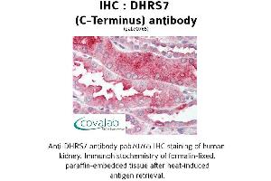 Image no. 1 for anti-Dehydrogenase/reductase (SDR Family) Member 7 (DHRS7) (C-Term) antibody (ABIN1733630) (DHRS7 anticorps  (C-Term))